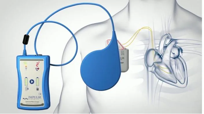Heart Institute Medical Director First in California to Implant New Heart Failure Device